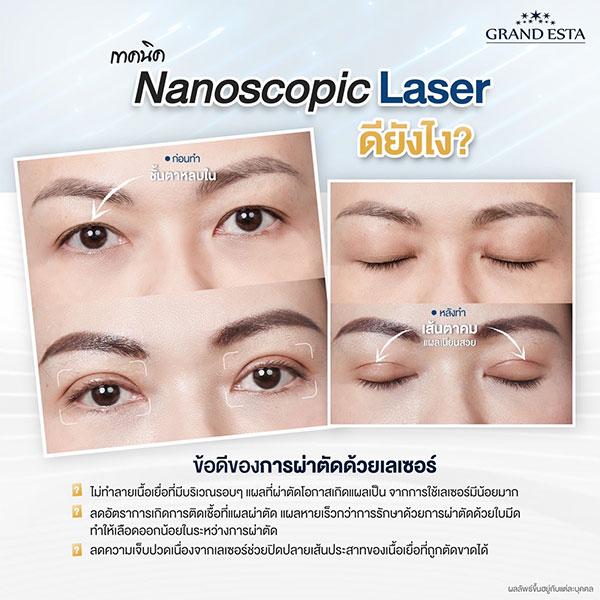 เทคนิค Nanoscopic Laser ดียังไง ??